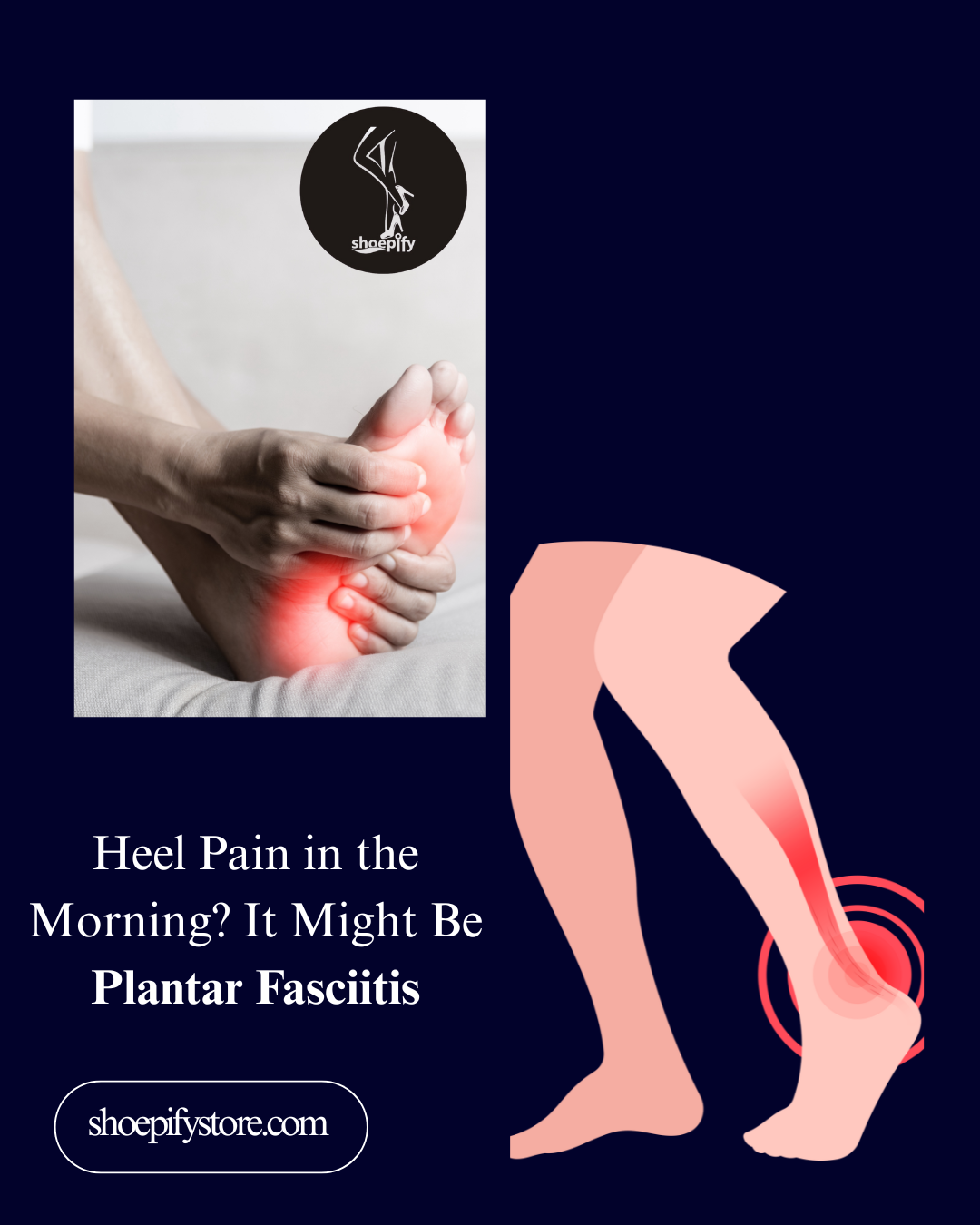 Heel Pain in the Morning? It Might Be Plantar Fasciitis: Here’s What to Know